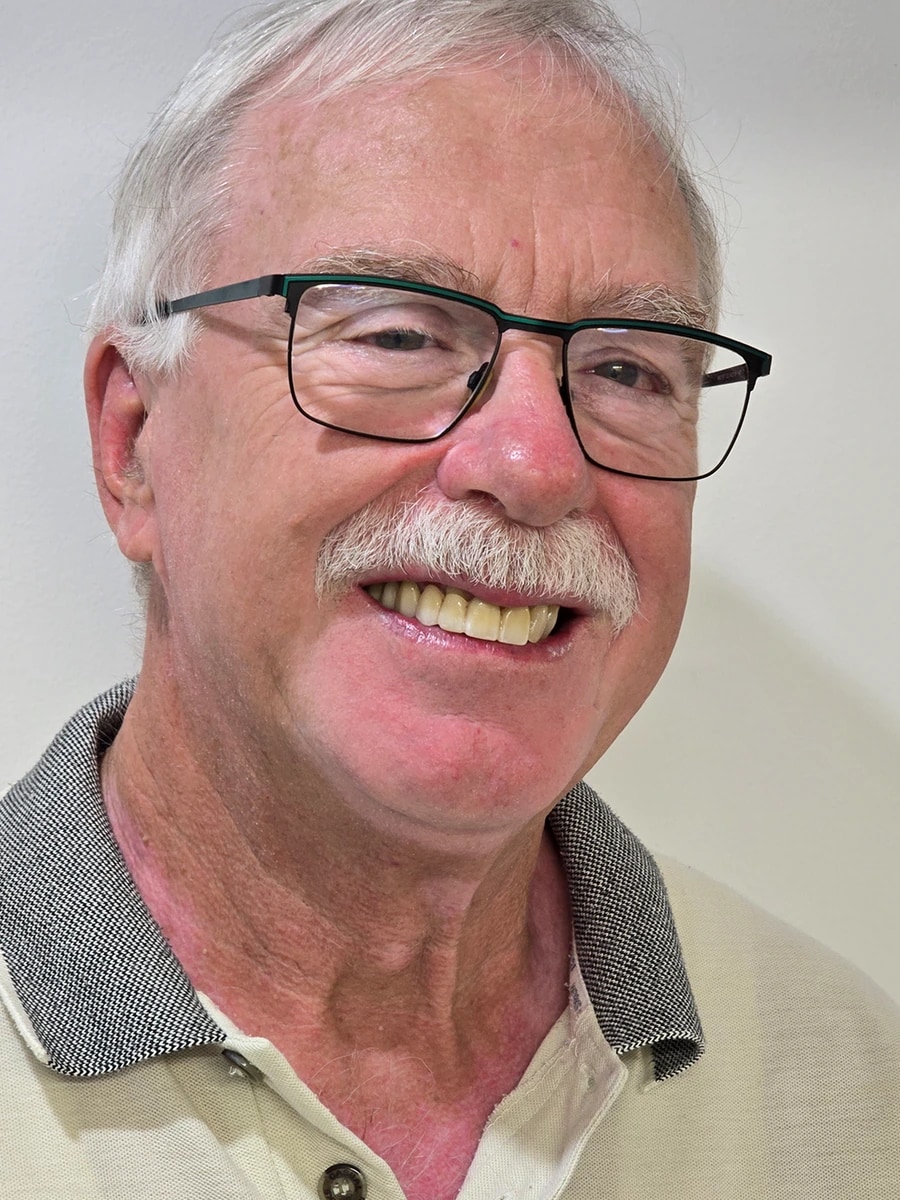 Patient 3 — after porcelain veneers